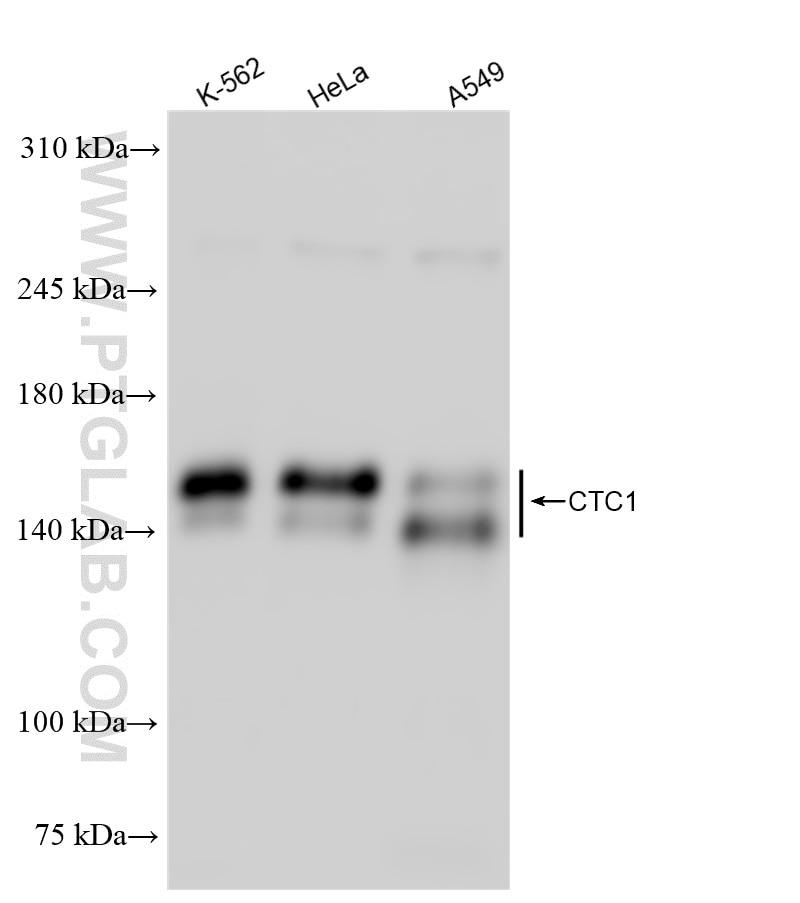 Western Blot (WB) analysis of various lysates using C17orf68 Recombinant antibody (84737-1-RR)
