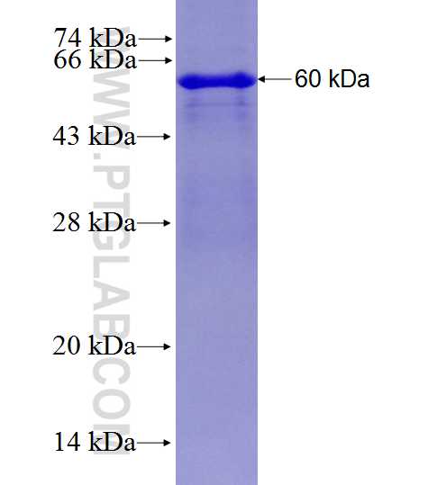 C17orf71 fusion protein Ag27820 SDS-PAGE