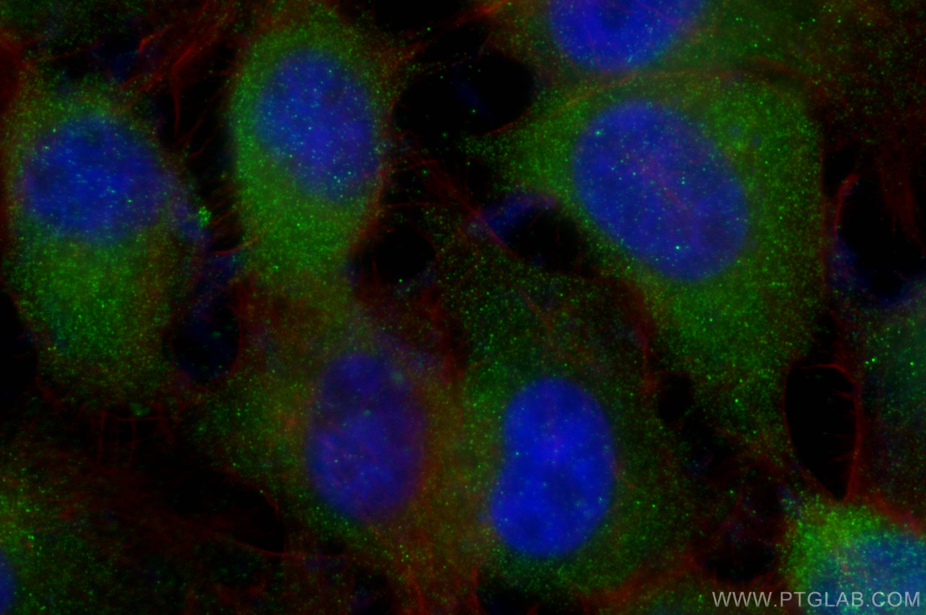 Immunofluorescence (IF) / fluorescent staining of A431 cells using C17orf75 Polyclonal antibody (26326-1-AP)