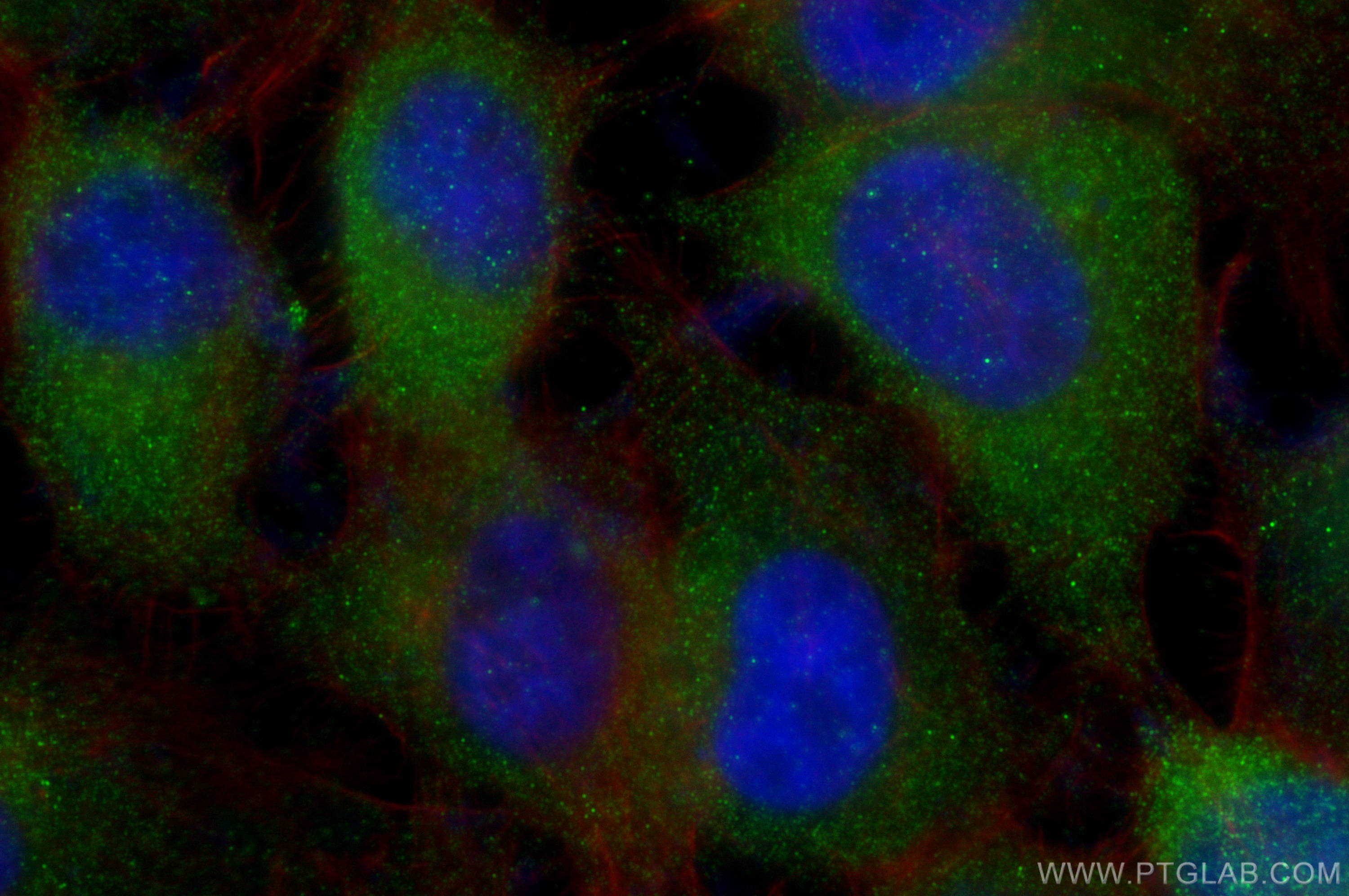 IF Staining of A431 using 26326-1-AP