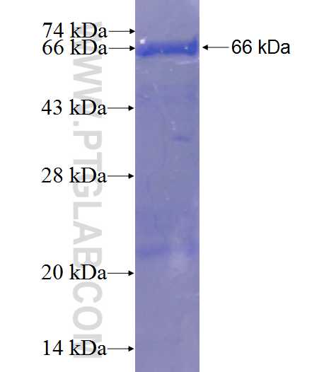C17orf75 fusion protein Ag23590 SDS-PAGE