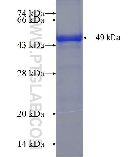 C17orf75 fusion protein Ag23638 SDS-PAGE