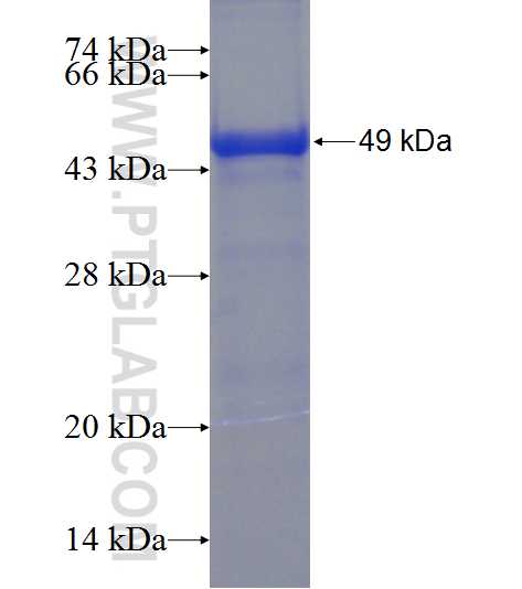 C17orf75 fusion protein Ag23638 SDS-PAGE