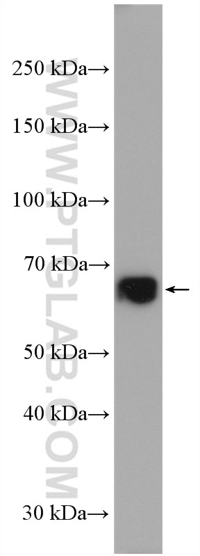 Western Blot (WB) analysis of HEK-293 cells using C17orf80 Polyclonal antibody (27762-1-AP)