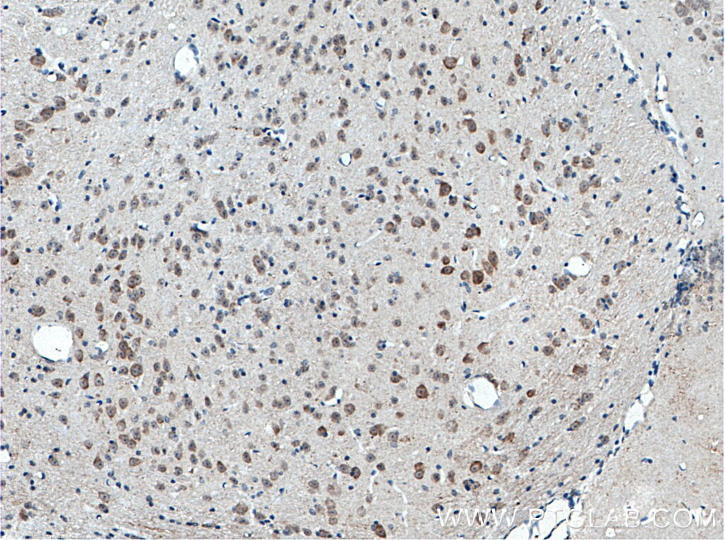 Immunohistochemistry (IHC) staining of mouse brain tissue using C17orf81 Polyclonal antibody (10162-1-AP)