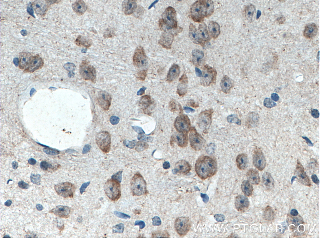 Immunohistochemistry (IHC) staining of mouse brain tissue using C17orf81 Polyclonal antibody (10162-1-AP)