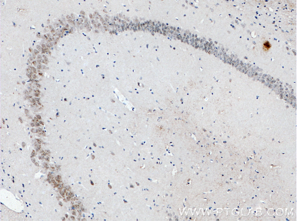 Immunohistochemistry (IHC) staining of mouse brain tissue using C17orf81 Polyclonal antibody (10162-1-AP)