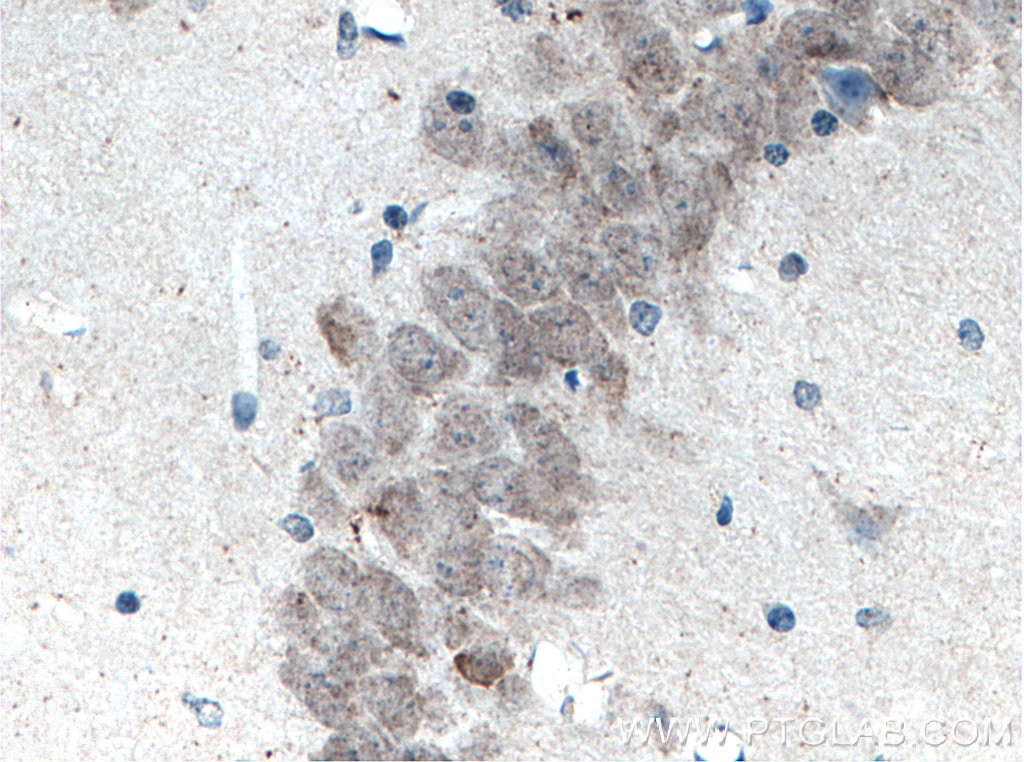 Immunohistochemistry (IHC) staining of mouse brain tissue using C17orf81 Polyclonal antibody (10162-1-AP)
