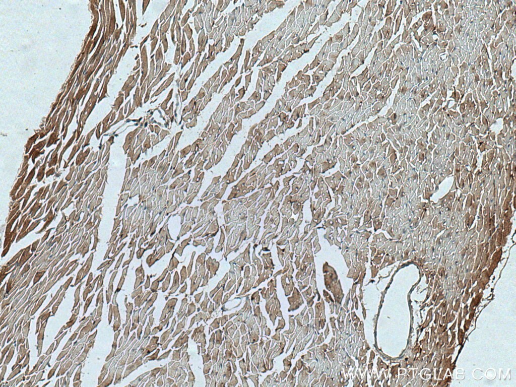 Immunohistochemistry (IHC) staining of mouse heart tissue using C17orf81 Polyclonal antibody (10162-1-AP)