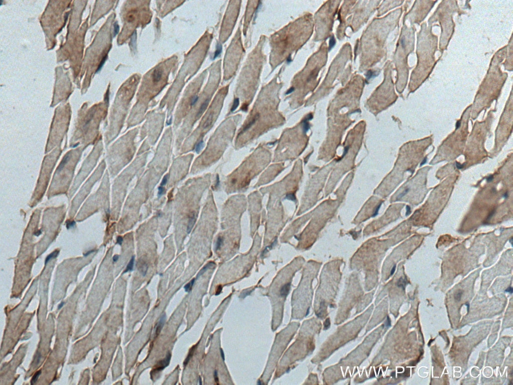 Immunohistochemistry (IHC) staining of mouse heart tissue using C17orf81 Polyclonal antibody (10162-1-AP)