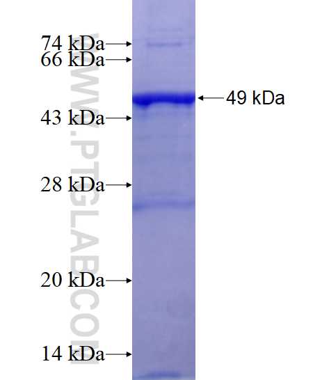C17orf81 fusion protein Ag0194 SDS-PAGE