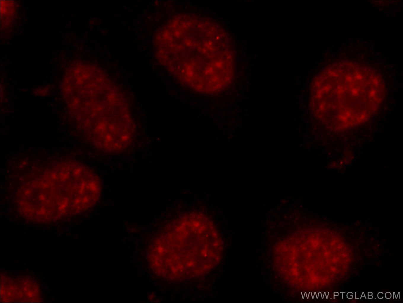 Immunofluorescence (IF) / fluorescent staining of HeLa cells using NCBP3 Polyclonal antibody (24384-1-AP)