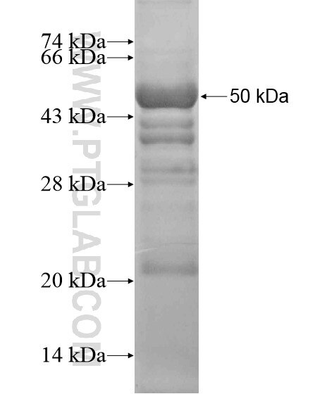 C17orf85 fusion protein Ag20021 SDS-PAGE