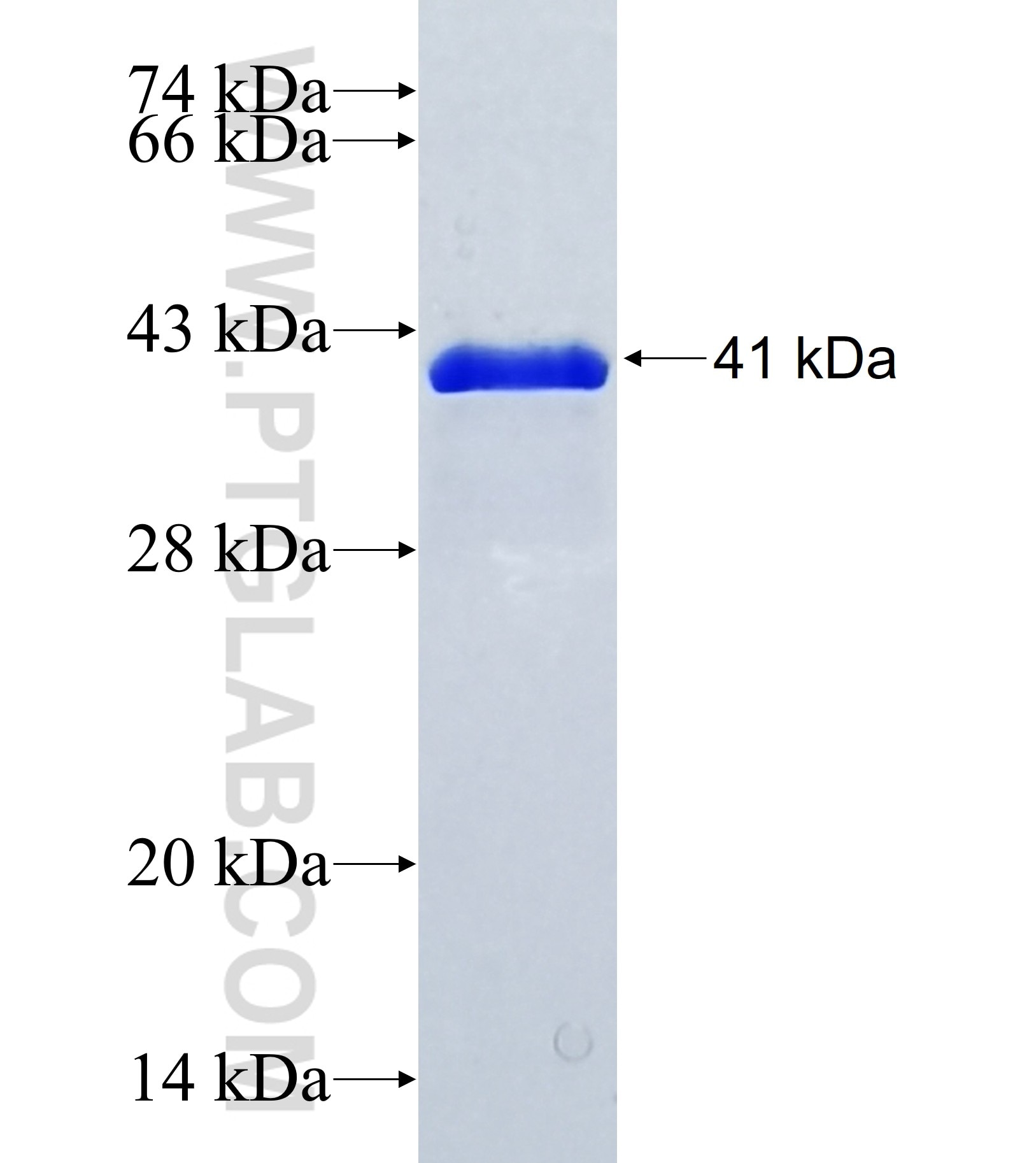 C17orf87 fusion protein Ag36999 SDS-PAGE C17orf87 fusion protein Ag36999 SDS-PAGE