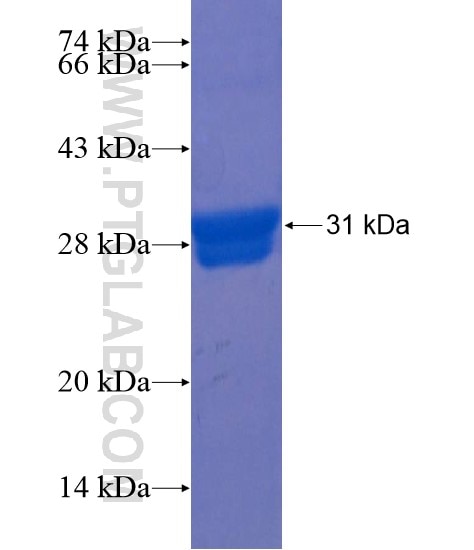 C18orf1 fusion protein Ag22173 SDS-PAGE
