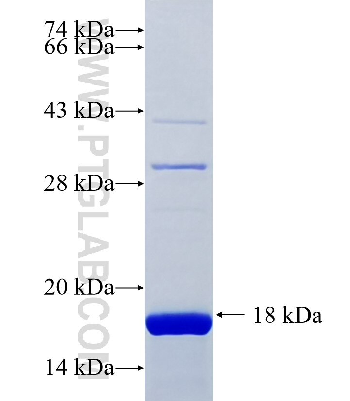C18orf19 fusion protein Ag36128 SDS-PAGE C18orf19 fusion protein Ag36128 SDS-PAGE