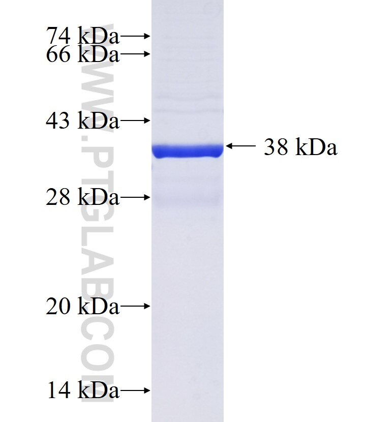 C18orf19 fusion protein Ag36161 SDS-PAGE