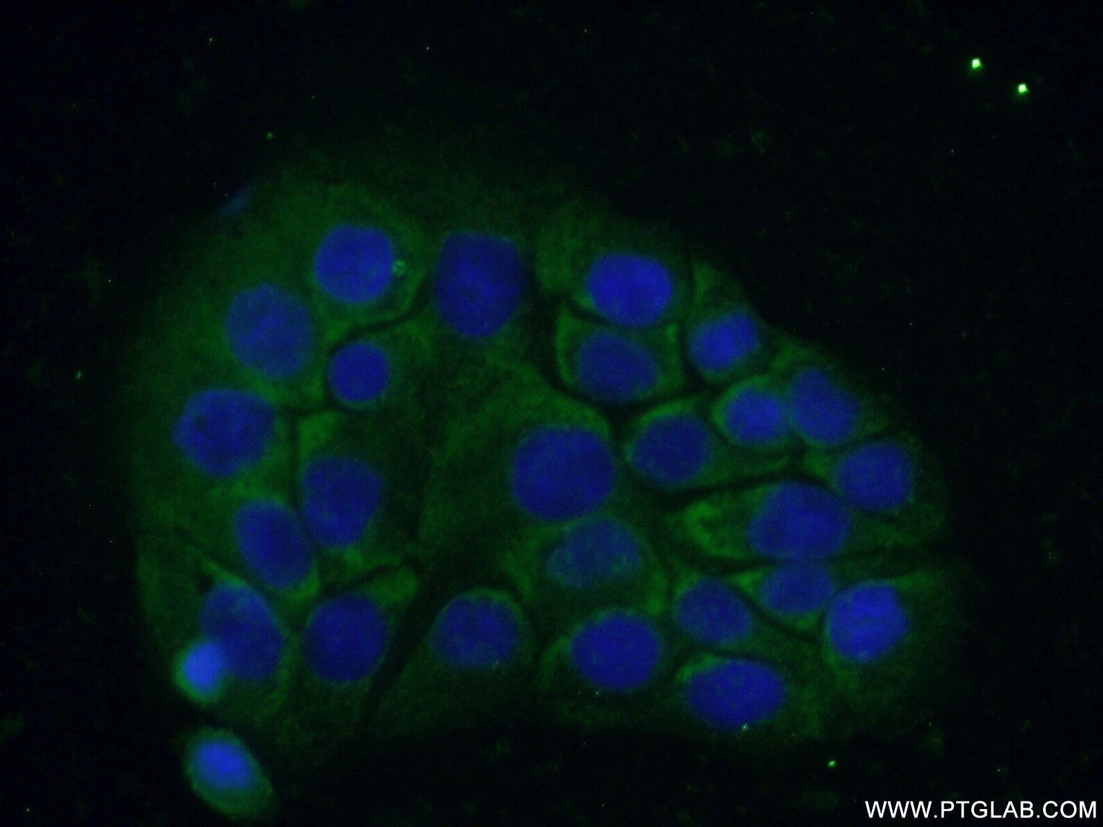 Immunofluorescence (IF) / fluorescent staining of COLO 320 cells using C18orf21 Polyclonal antibody (24977-1-AP)