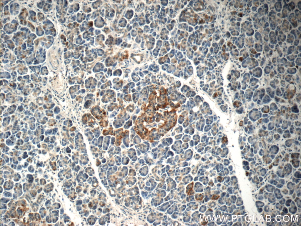 Immunohistochemistry (IHC) staining of human pancreas tissue using C18orf21 Polyclonal antibody (24977-1-AP)
