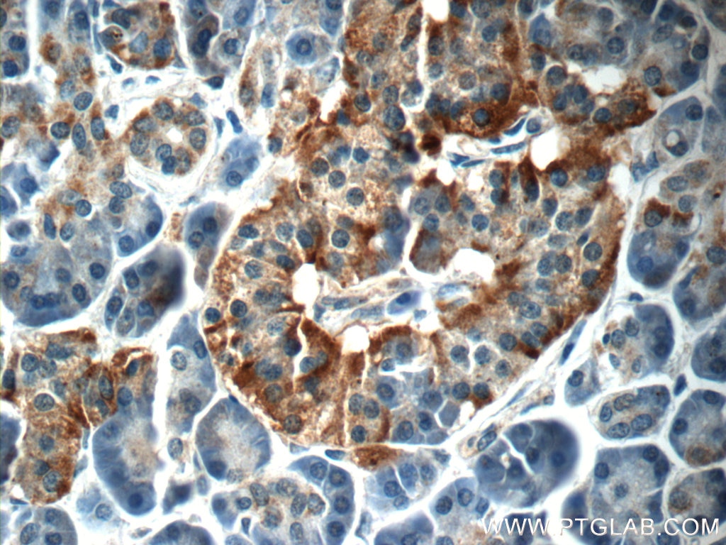 Immunohistochemistry (IHC) staining of human pancreas tissue using C18orf21 Polyclonal antibody (24977-1-AP)
