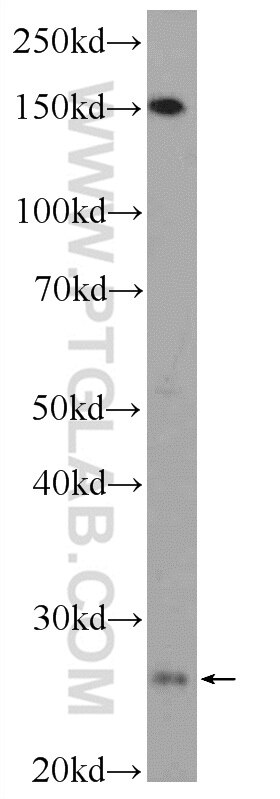 Western Blot (WB) analysis of COLO 320 cells using C18orf21 Polyclonal antibody (24977-1-AP)