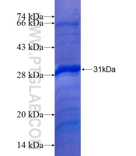 C18orf21 fusion protein Ag21782 SDS-PAGE