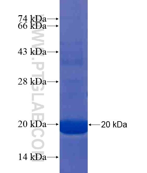 C18orf22 fusion protein Ag20458 SDS-PAGE