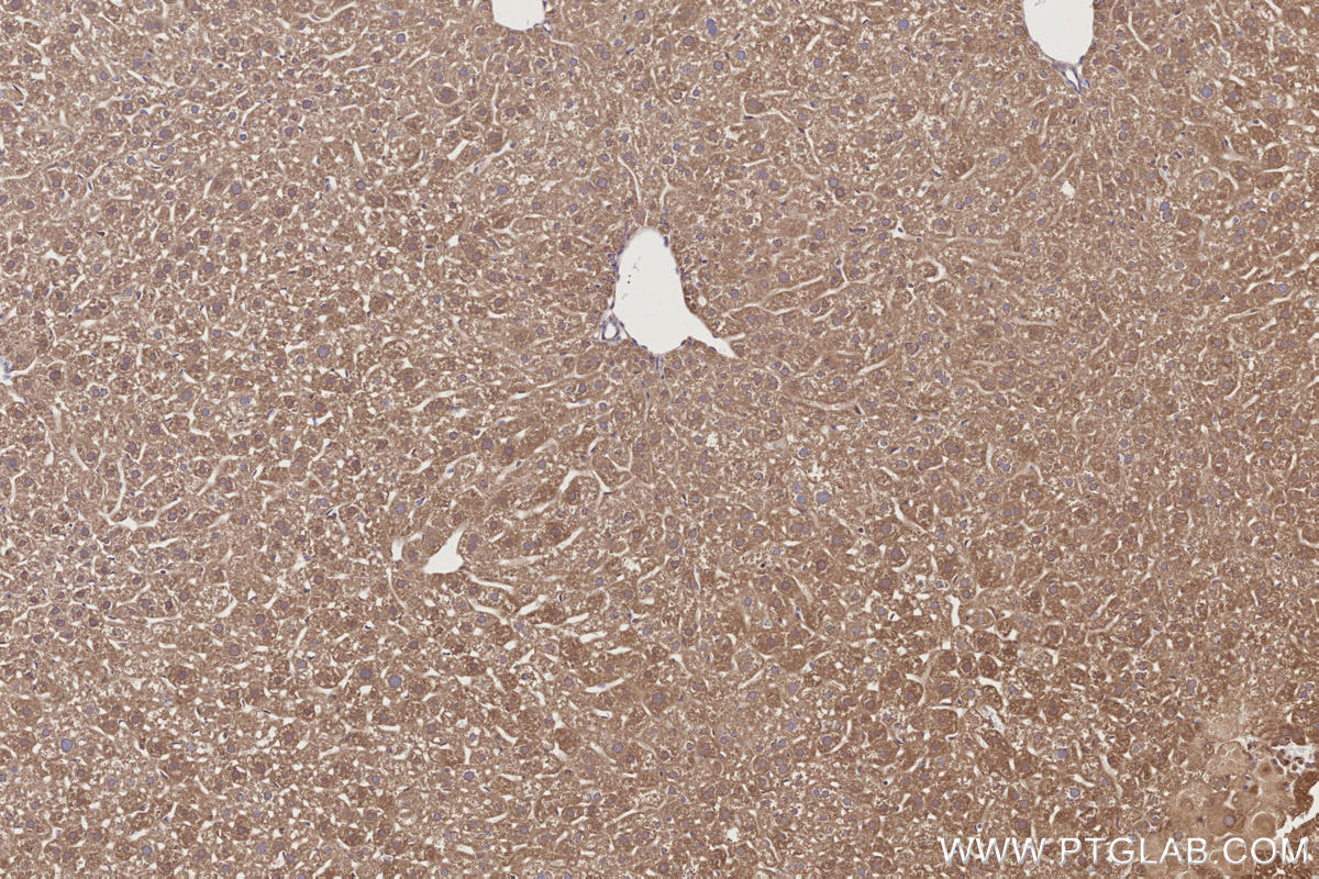 IHC staining of mouse liver using 31161-1-AP Immunohistochemistry (IHC) staining of mouse liver tissue using C18orf24 Polyclonal antibody (31161-1-AP)