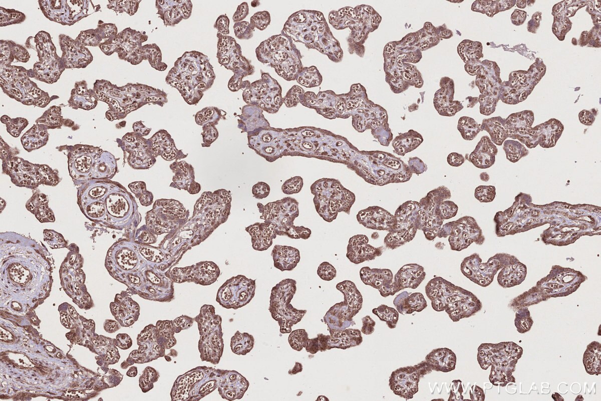 IHC staining of human placenta using 31161-1-AP Immunohistochemistry (IHC) staining of human placenta tissue using C18orf24 Polyclonal antibody (31161-1-AP)