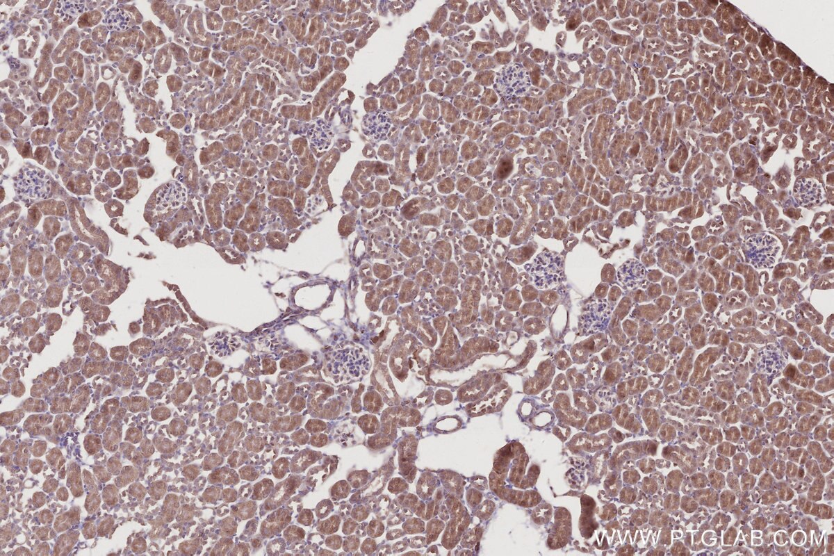 IHC staining of mouse kidney using 31161-1-AP Immunohistochemistry (IHC) staining of mouse kidney tissue using C18orf24 Polyclonal antibody (31161-1-AP)