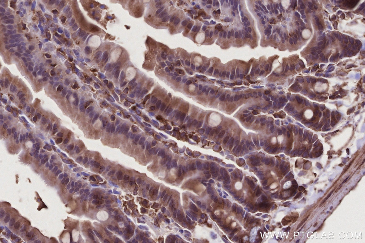IHC staining of mouse small intestine using 31161-1-AP Immunohistochemistry (IHC) staining of mouse small intestine tissue using C18orf24 Polyclonal antibody (31161-1-AP)