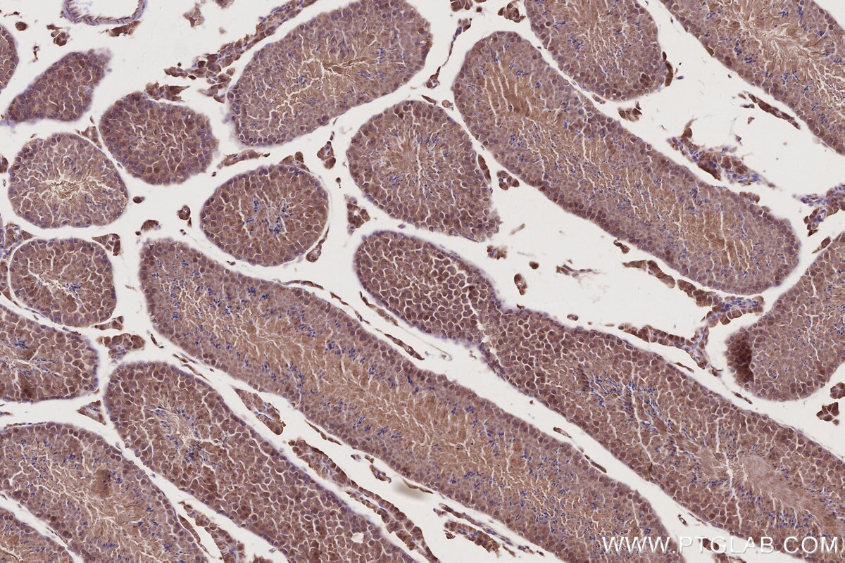 IHC staining of mouse testis using 31161-1-AP Immunohistochemistry (IHC) staining of mouse testis tissue using C18orf24 Polyclonal antibody (31161-1-AP)