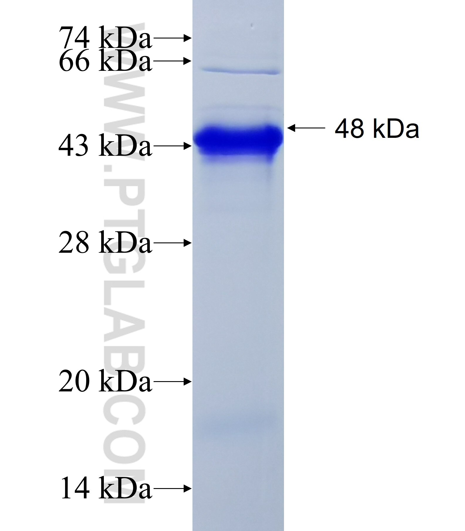 C18orf25 fusion protein Ag33398 SDS-PAGE C18orf25 fusion protein Ag33398 SDS-PAGE