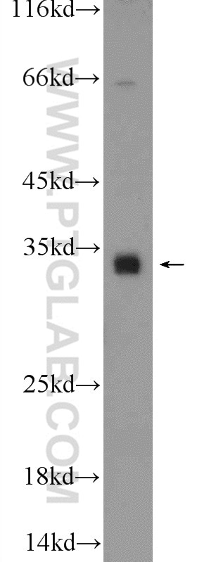 Western Blot (WB) analysis of A431 cells using C18orf45 Polyclonal antibody (25499-1-AP)