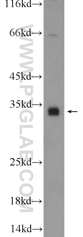 Western Blot (WB) analysis of A431 cells using C18orf45 Polyclonal antibody (25499-1-AP)