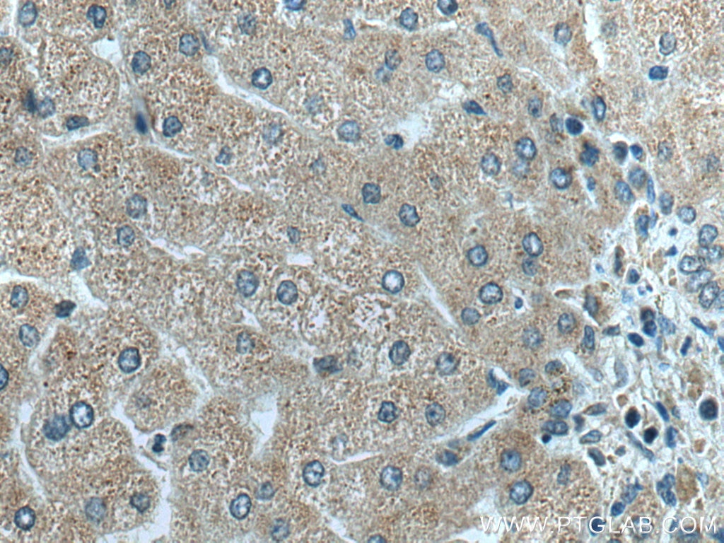 Immunohistochemistry (IHC) staining of human liver tissue using Tim21 Polyclonal antibody (16641-1-AP)
