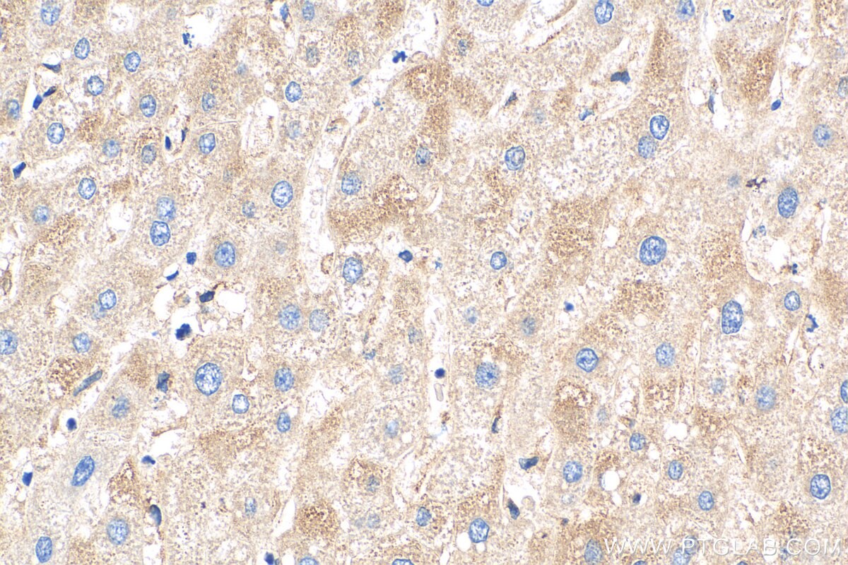 Immunohistochemistry (IHC) staining of human liver tissue using Tim21 Polyclonal antibody (16641-1-AP)