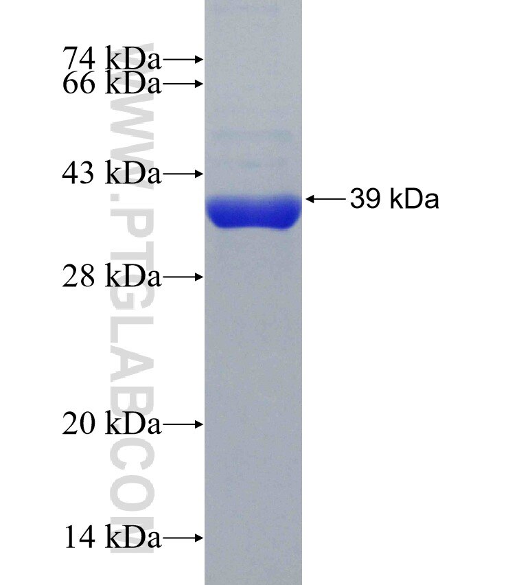 C18orf55 fusion protein Ag31220 SDS-PAGE C18orf55 fusion protein Ag31220 SDS-PAGE
