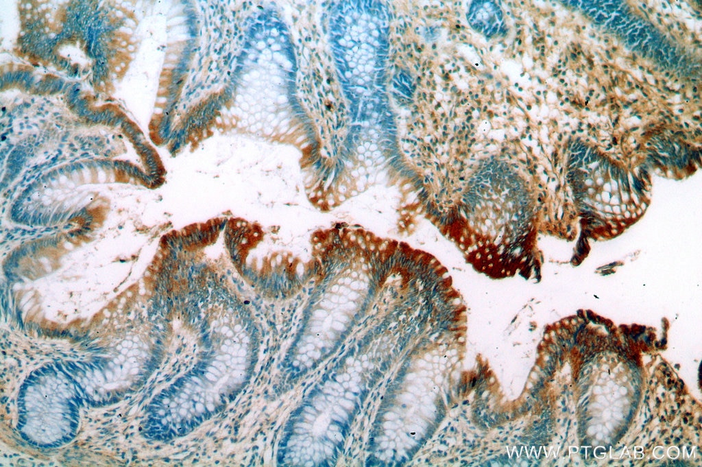 IHC staining of human colon using 20111-1-AP