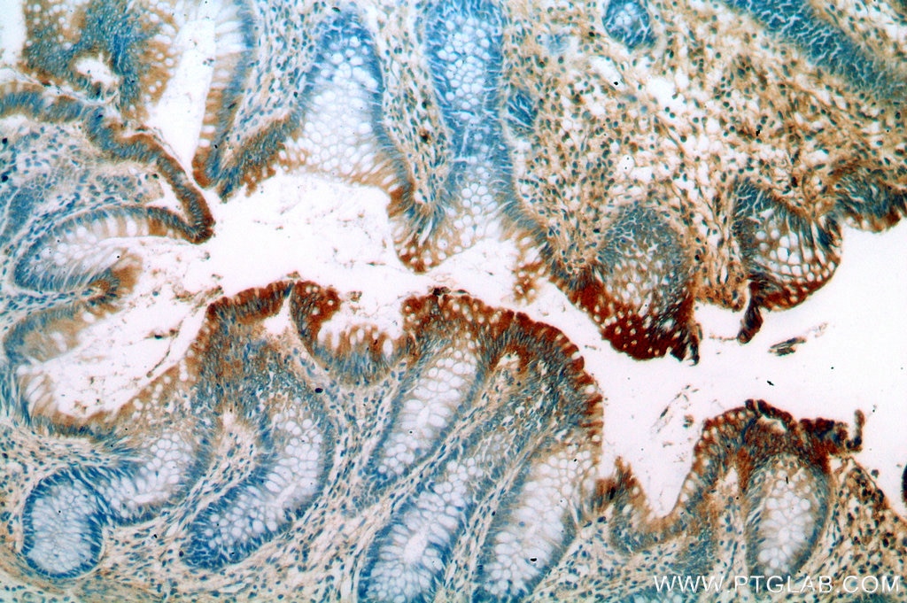 Immunohistochemistry (IHC) staining of human colon tissue using RMC1 Polyclonal antibody (20111-1-AP)