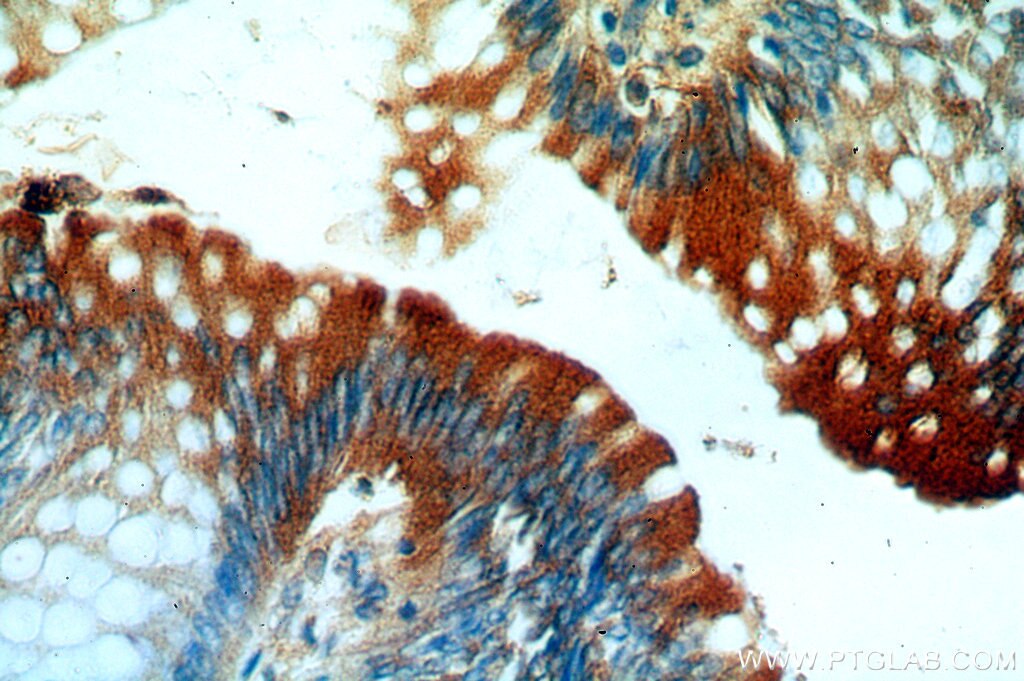 Immunohistochemistry (IHC) staining of human colon tissue using RMC1 Polyclonal antibody (20111-1-AP)