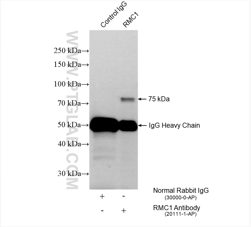 Immunoprecipitation (IP) experiment of MCF-7 cells using RMC1 Polyclonal antibody (20111-1-AP)