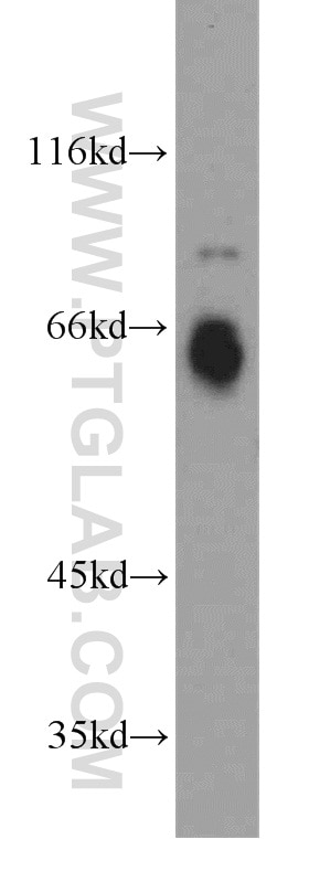 Western Blot (WB) analysis of human brain tissue using RMC1 Polyclonal antibody (20111-1-AP)