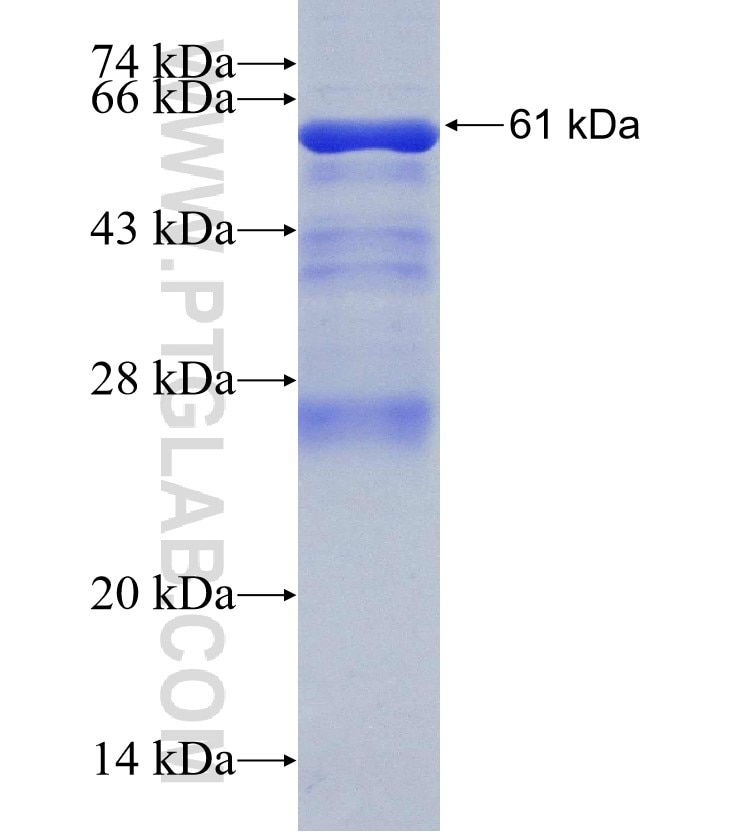 C18orf8 fusion protein Ag13904 SDS-PAGE