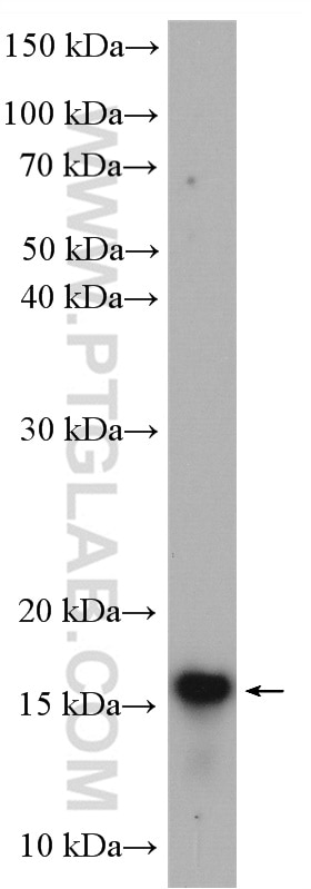 WB analysis of mouse colon using 11353-1-AP