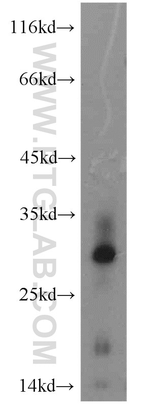 Western Blot (WB) analysis of HeLa cells using MYDGF/C19orf10 Polyclonal antibody (11353-1-AP)