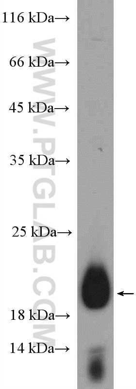 Western Blot (WB) analysis of U2OS cells using C19orf12 Polyclonal antibody (27382-1-AP)