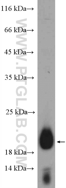 Western Blot (WB) analysis of U2OS cells using C19orf12 Polyclonal antibody (27382-1-AP)