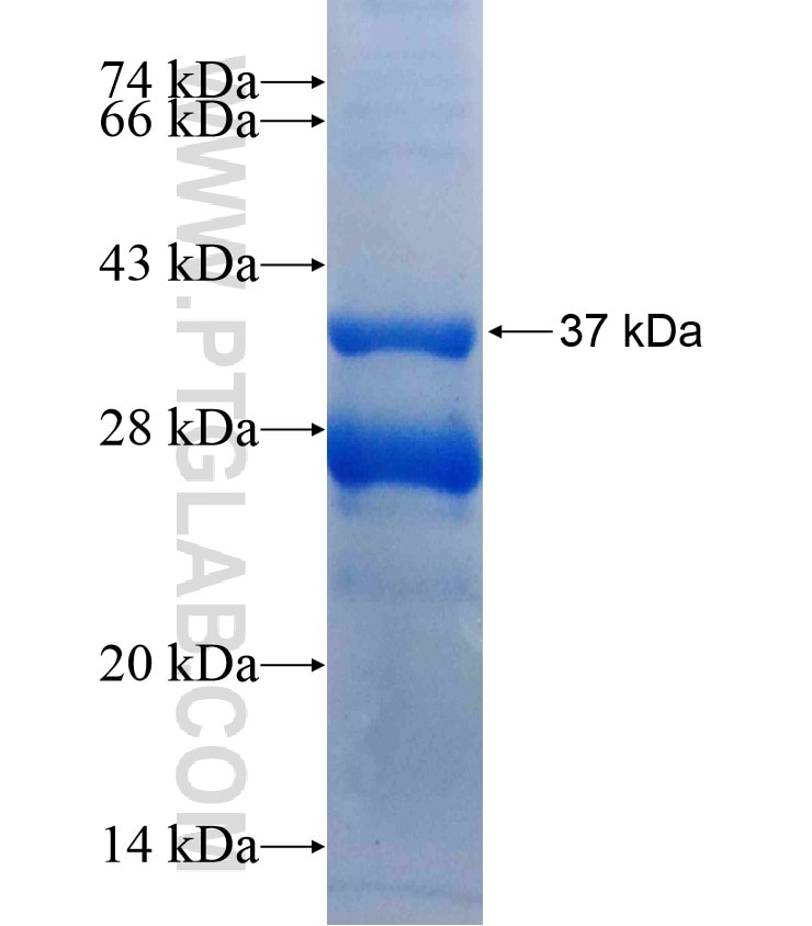C19orf12 fusion protein Ag18308 SDS-PAGE