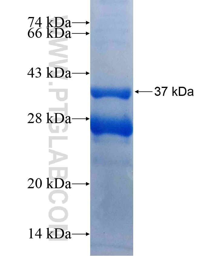 C19orf12 fusion protein Ag18308 SDS-PAGE